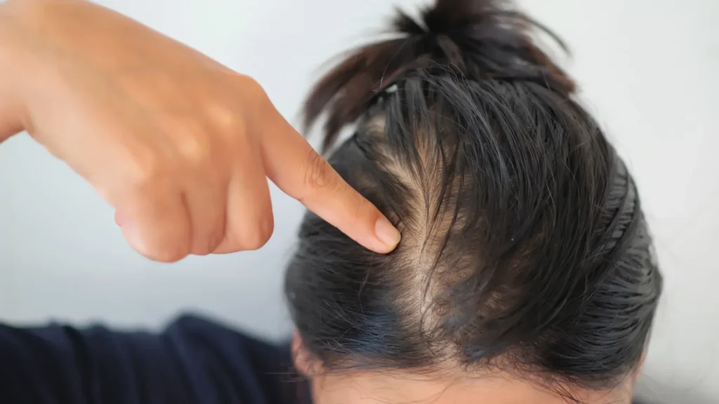 penteados para formatura cabelo fino